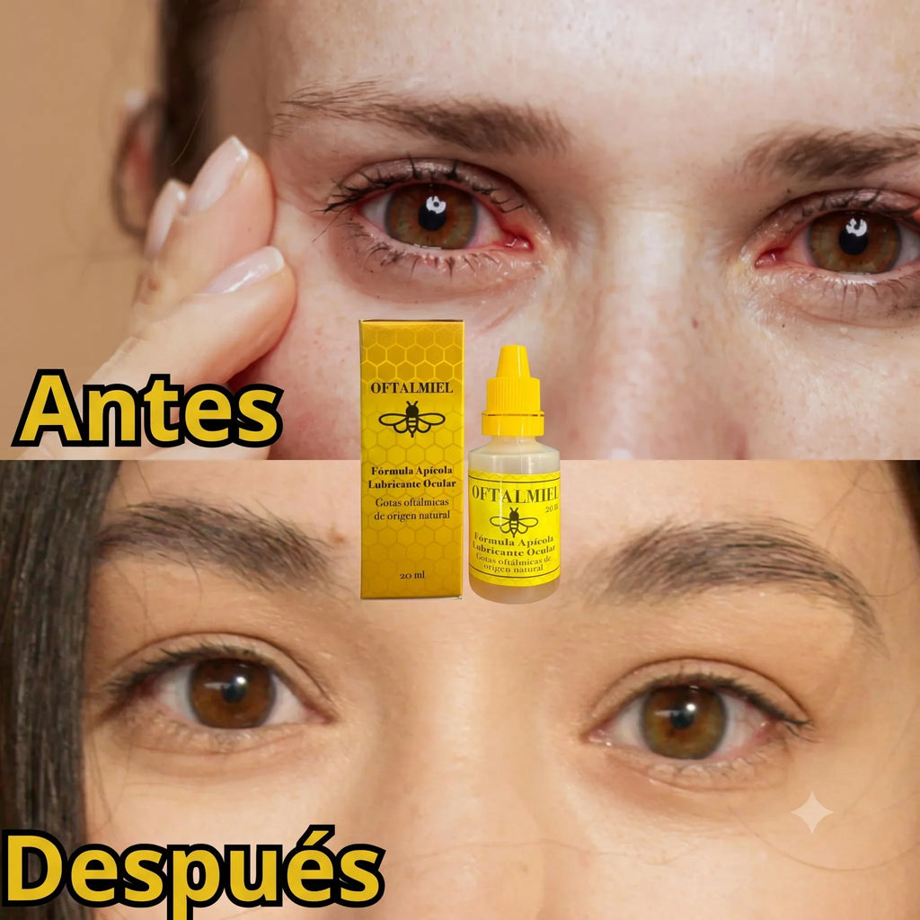 🐝 Oftalmiel — Las Gotas Naturales de Miel que Alivian Ojos Secos y Visión Borrosa  🚚 ¡Envío GRATIS!