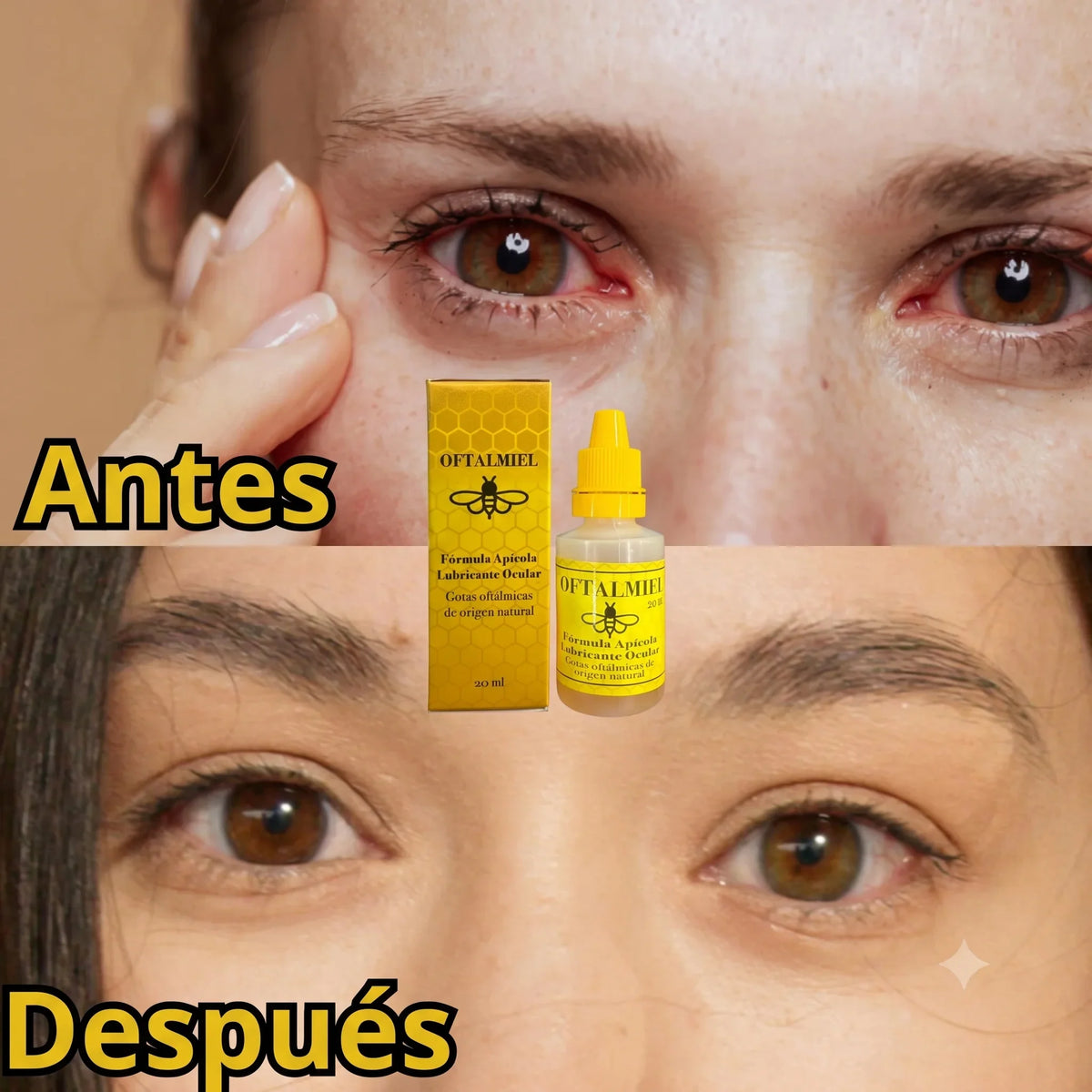 🐝 Oftalmiel — Las Gotas Naturales de Miel que Alivian Ojos Secos y Visión Borrosa  🚚 ¡Envío GRATIS!